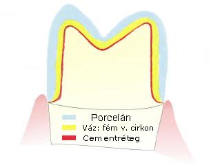 fogászat dentistry XI.kerület DaviDent - Zsila Dávid rendelője - fog teeth